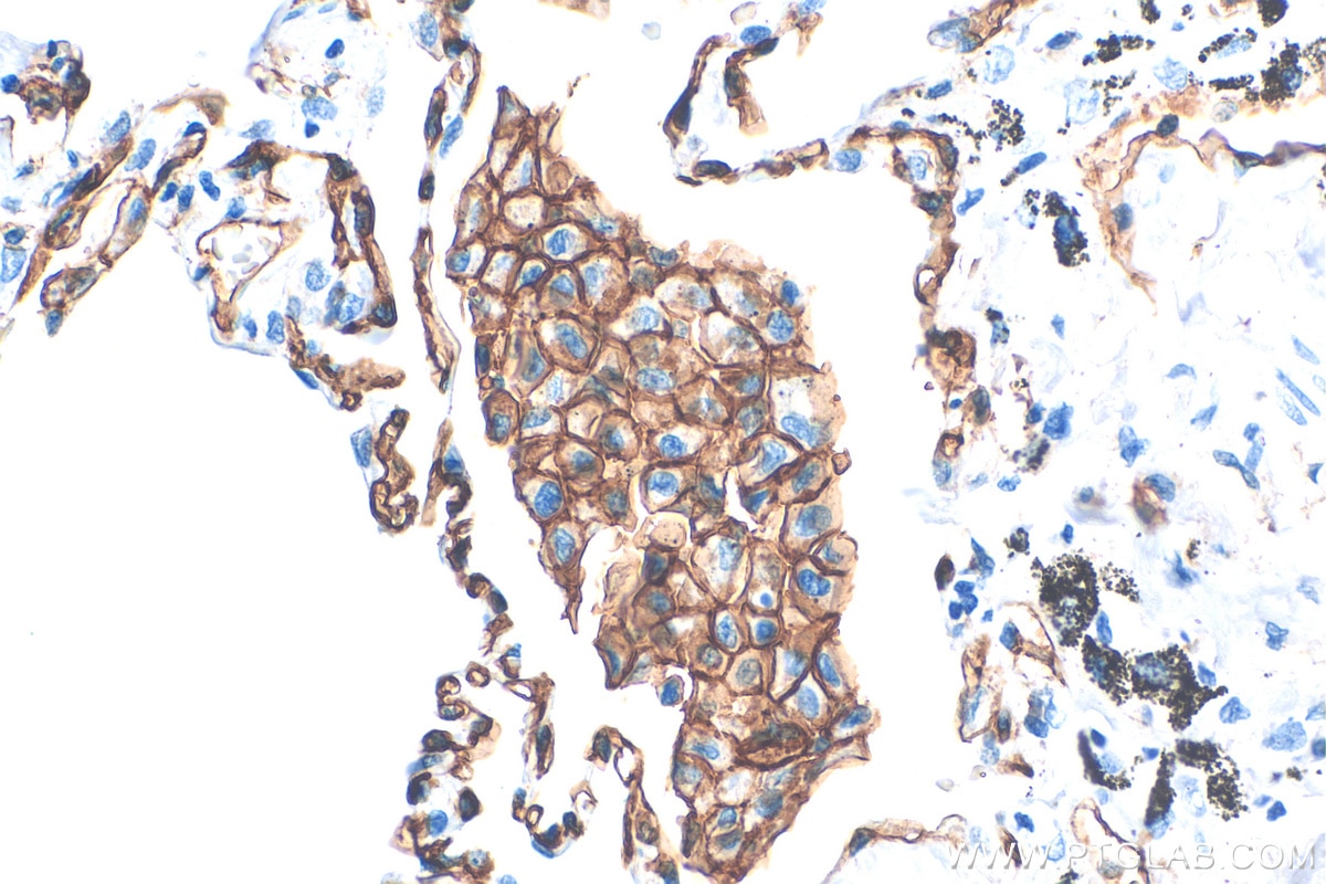Immunohistochemistry (IHC) staining of human lung tissue using Thrombomodulin Recombinant antibody (83416-4-RR)