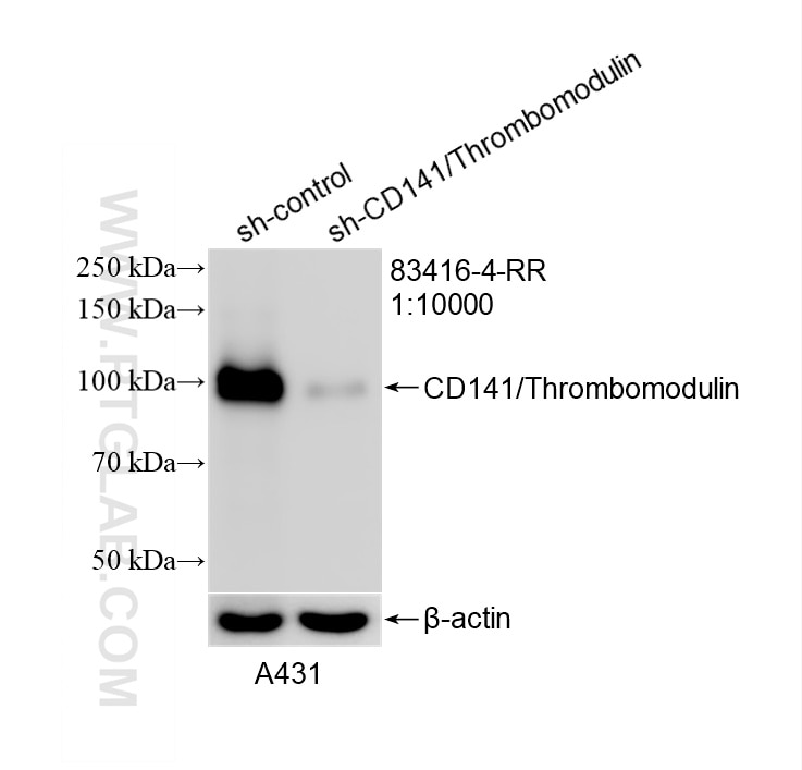 WB result of CD141/Thrombomodulin antibody (83416-4-RR; 1:10000; incubated at room temperature for 1.5 hours) with sh-Control and sh-CD141/Thrombomodulin transfected A431 cells. Western Blot (WB) analysis of A431 cells using CD141/Thrombomodulin Recombinant monoclonal antibo (83416-4-RR)