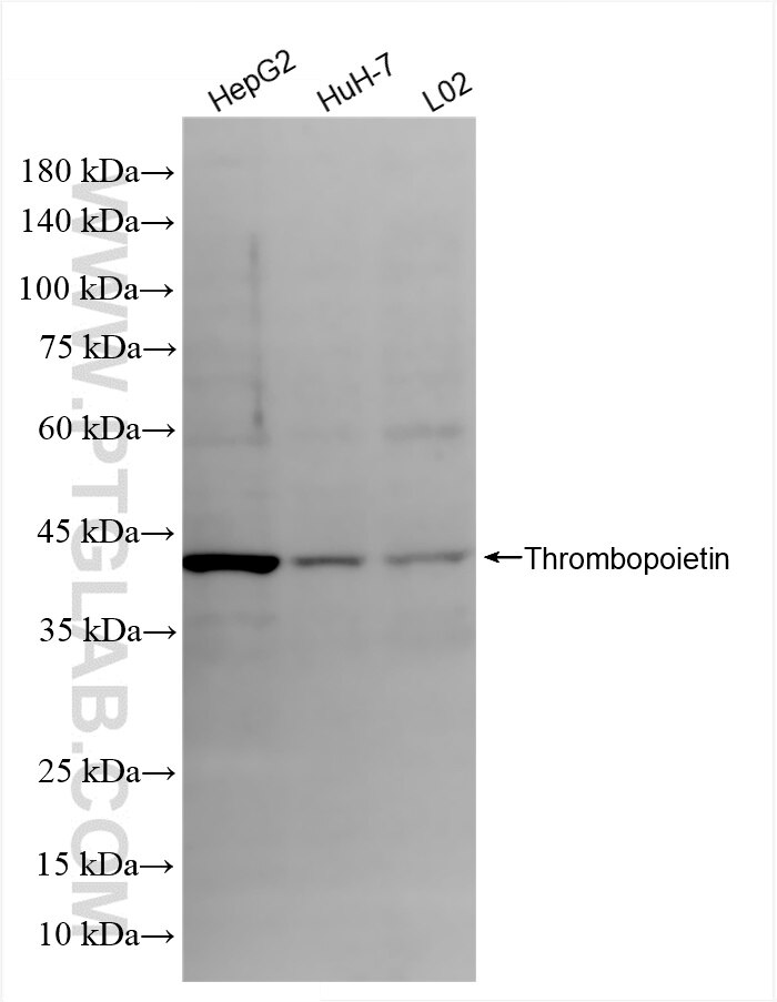 Western Blot (WB) analysis of various lysates using Thrombopoietin Recombinant antibody (83549-7-RR)