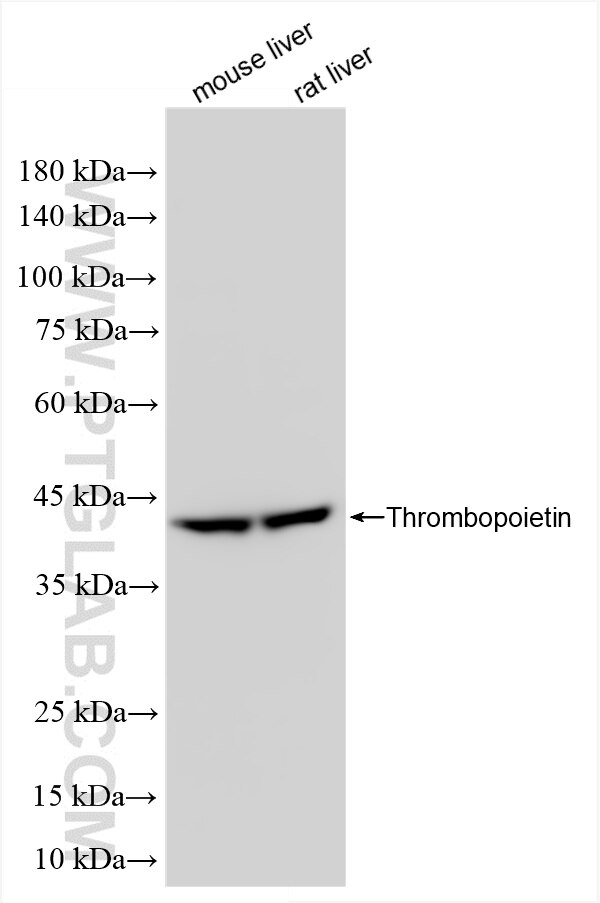 Western Blot (WB) analysis of various lysates using Thrombopoietin Recombinant antibody (83549-7-RR)
