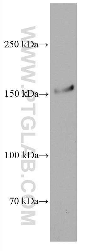 Western Blot (WB) analysis of rat spleen tissue using Thrombospondin 1 Monoclonal antibody (67241-1-Ig)