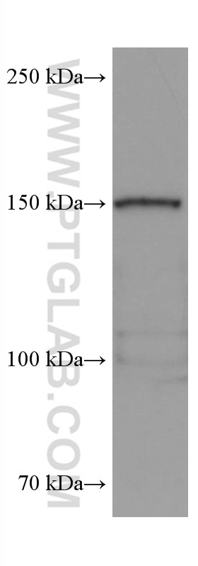 Western Blot (WB) analysis of NIH/3T3 cells using Thrombospondin 1 Monoclonal antibody (67241-1-Ig)