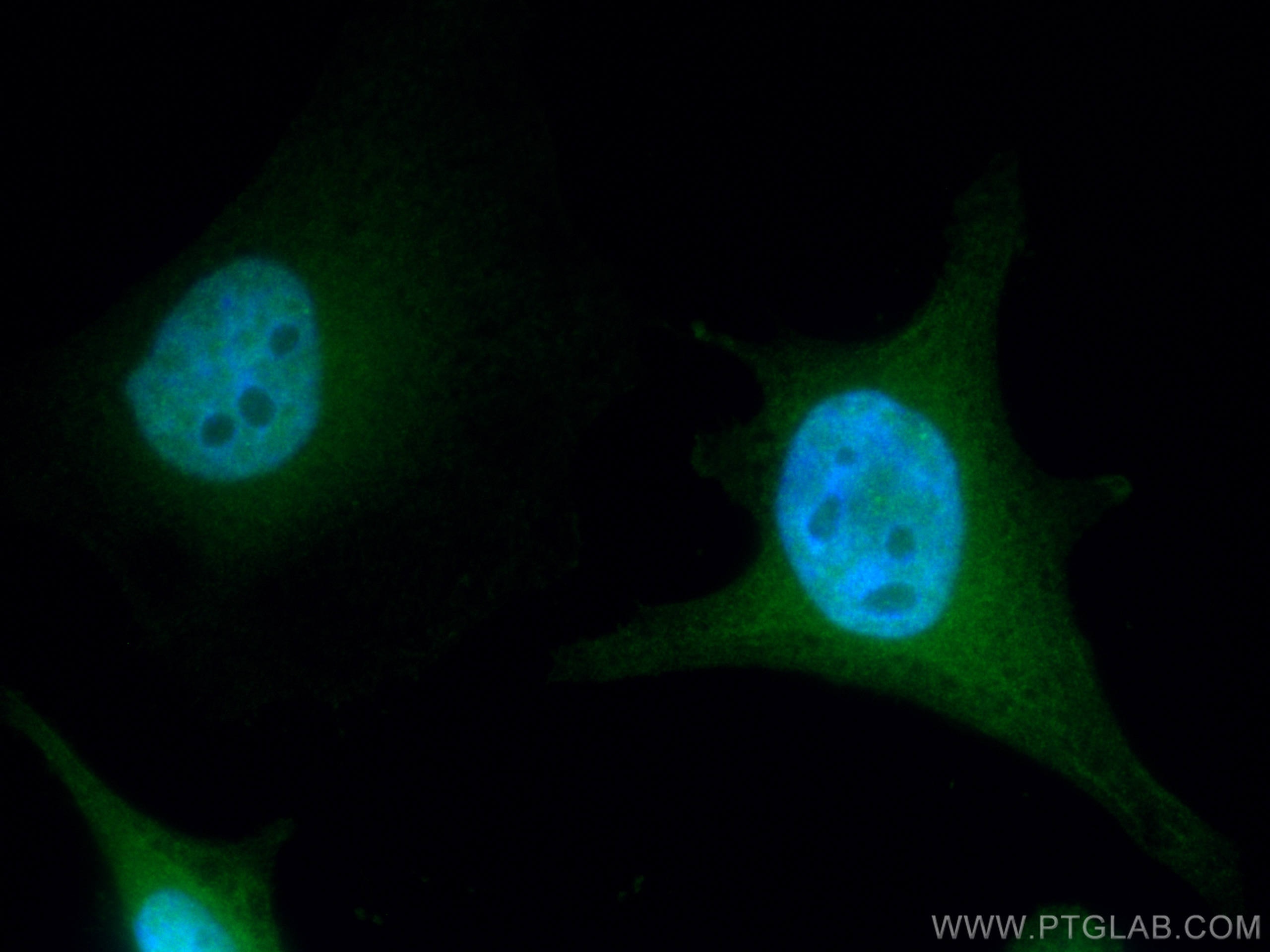 Immunofluorescence (IF) / fluorescent staining of HeLa cells using CoraLite® Plus 488-conjugated Thymidylate synthase (CL488-15047)