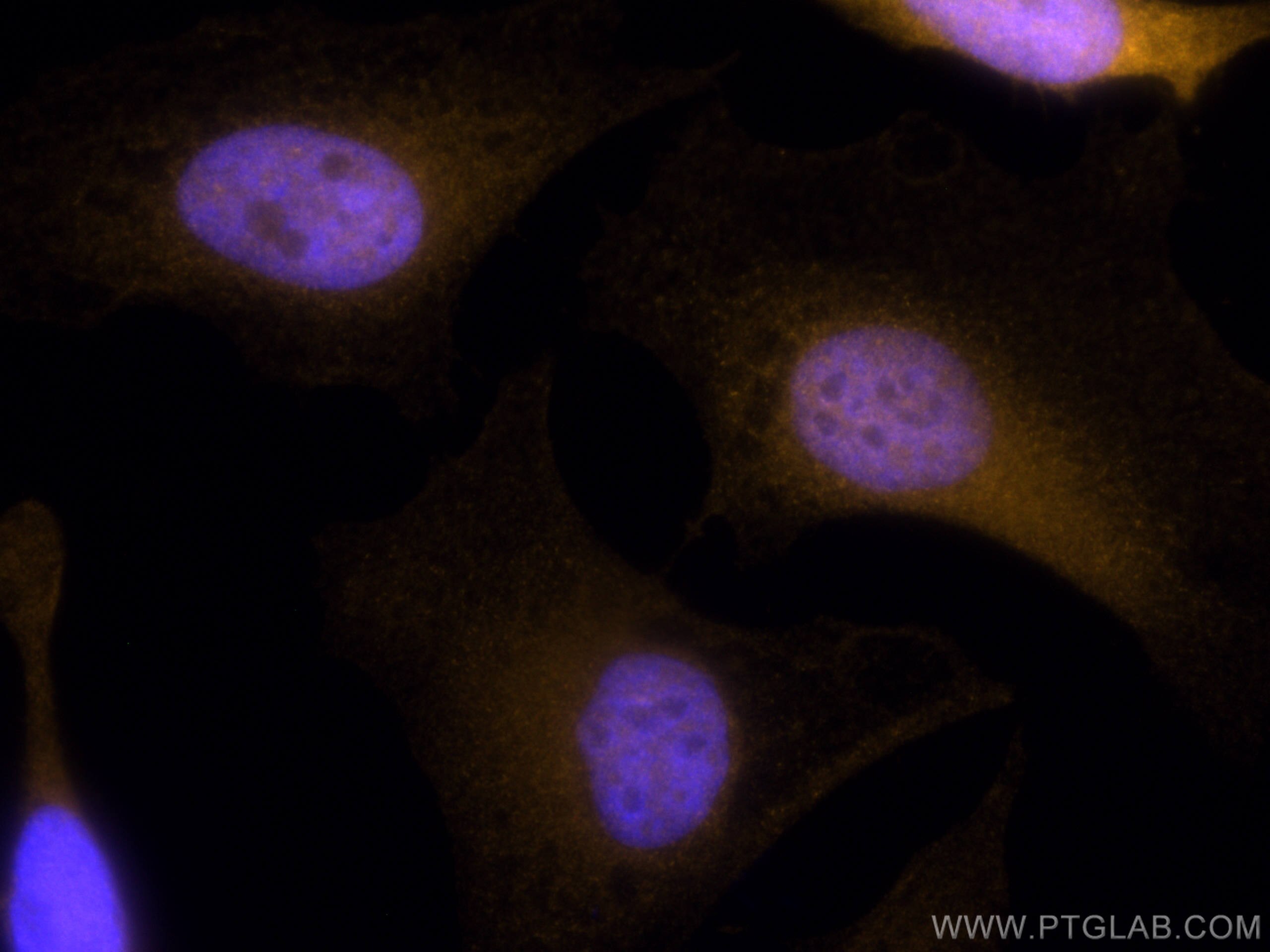 Immunofluorescence (IF) / fluorescent staining of HeLa cells using CoraLite®555-conjugated Thymidylate synthase Polyc (CL555-15047)