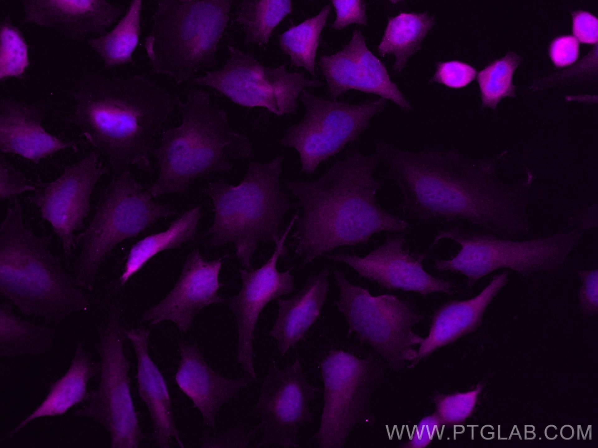 Immunofluorescence (IF) / fluorescent staining of HeLa cells using CoraLite® Plus 647-conjugated Thymidylate synthase (CL647-15047)