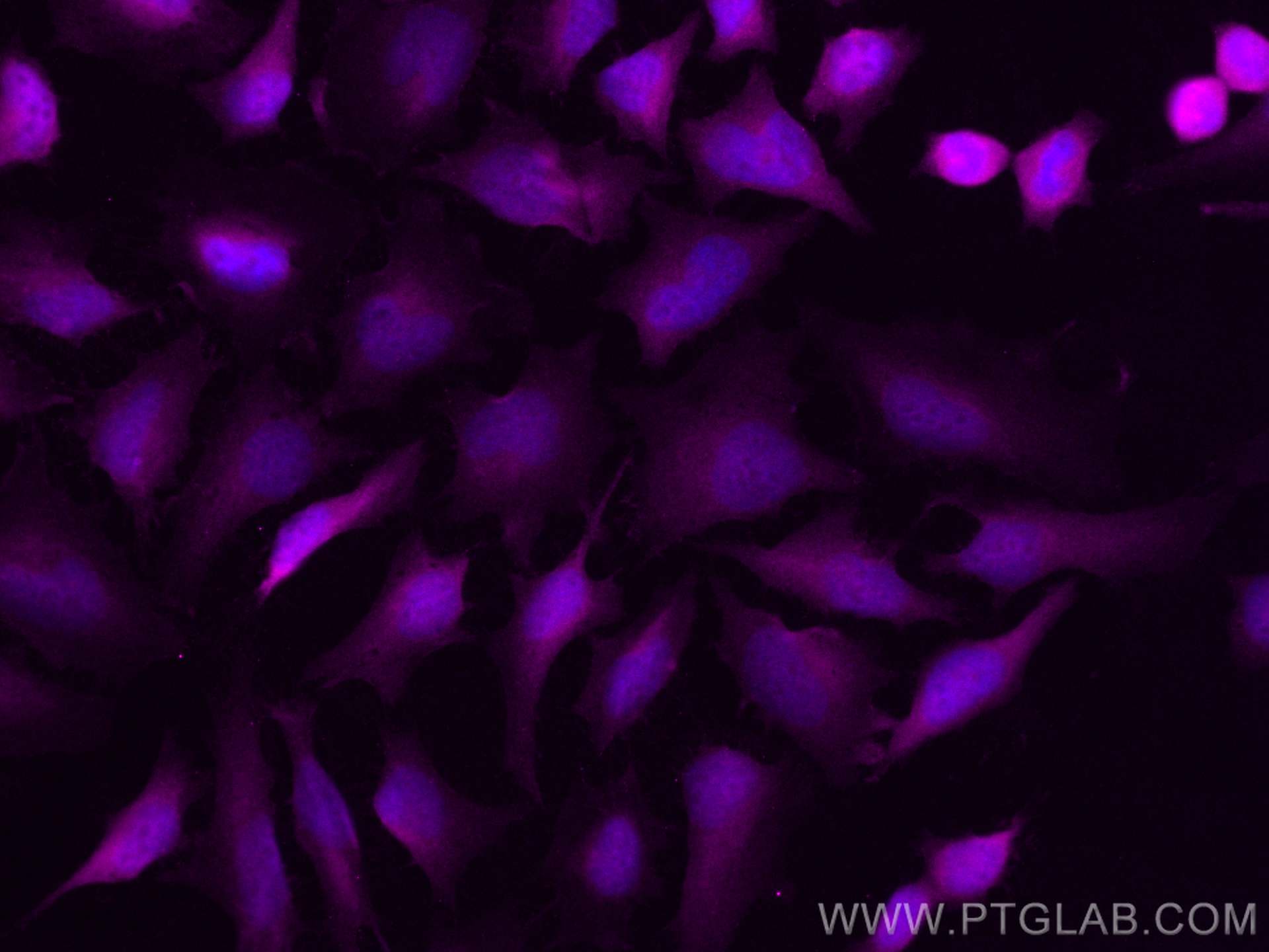 IF Staining of HeLa using CL647-15047