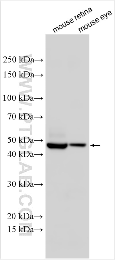 Western Blot (WB) analysis of various lysates using Thyroid Hormone Receptor beta Polyclonal antibody (21007-1-AP)