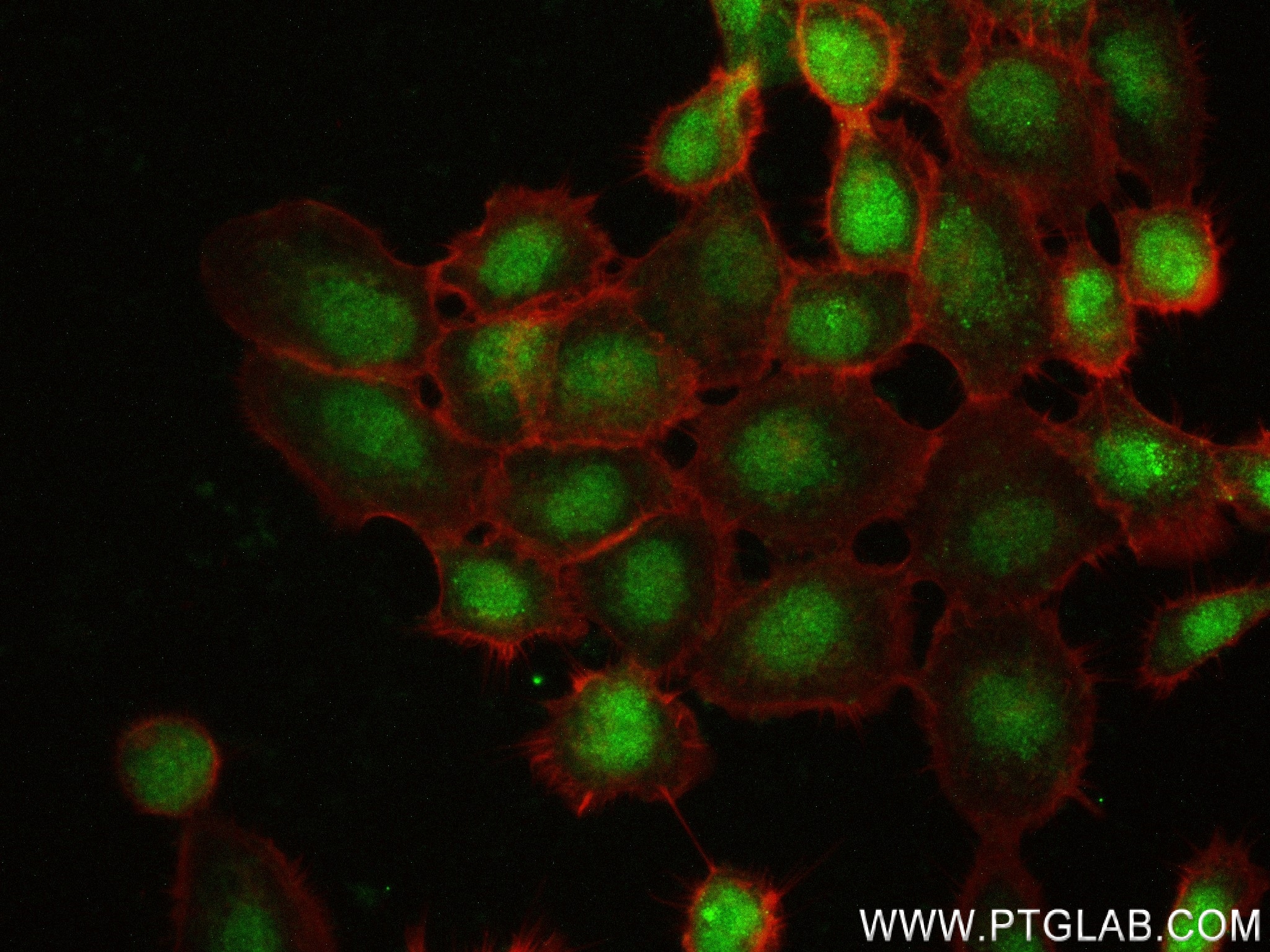 Thyroid Hormone Receptor beta