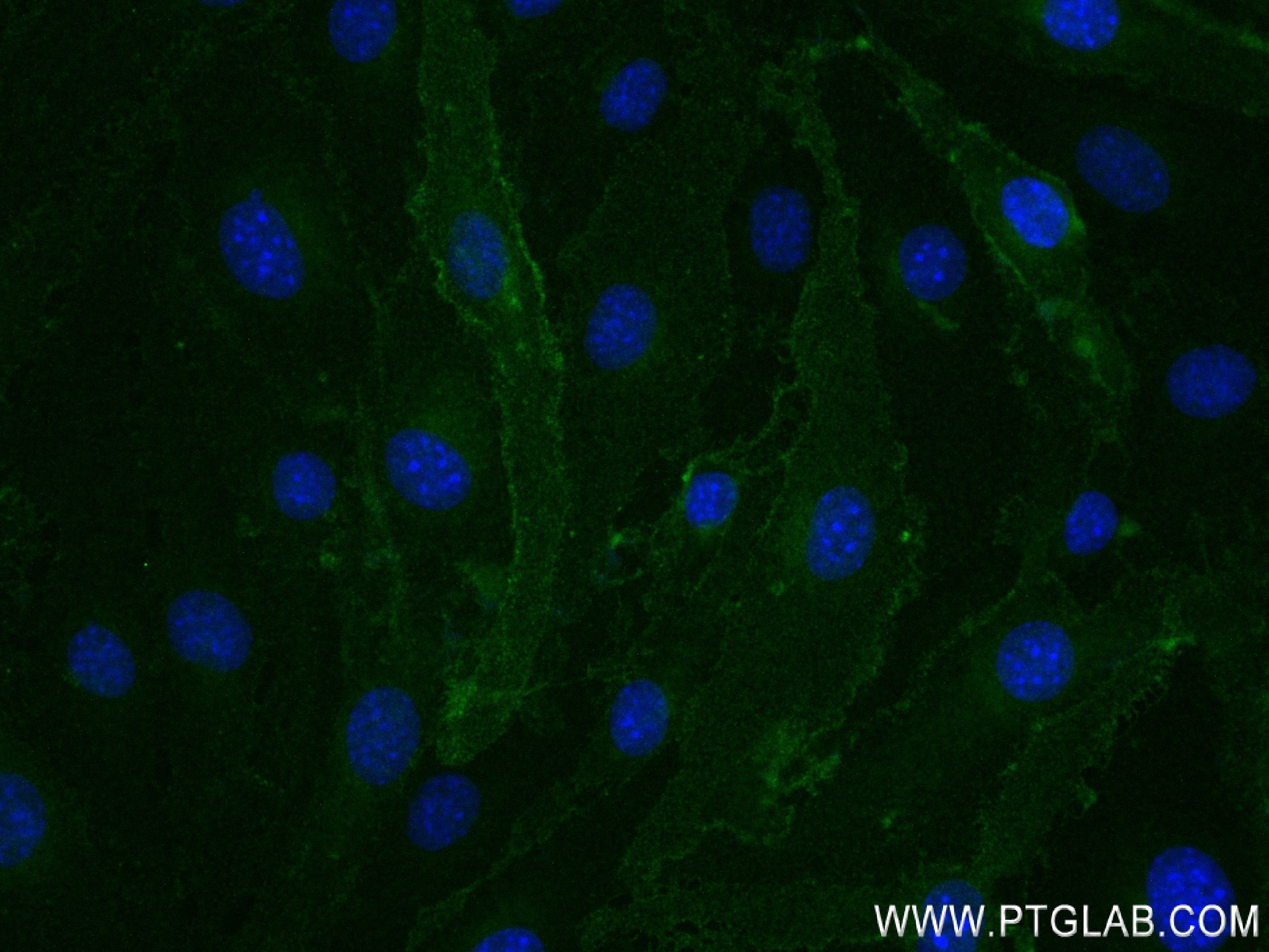 Immunofluorescence (IF) / fluorescent staining of bEnd.3 cells using Tie-2 Recombinant antibody (84469-5-RR)