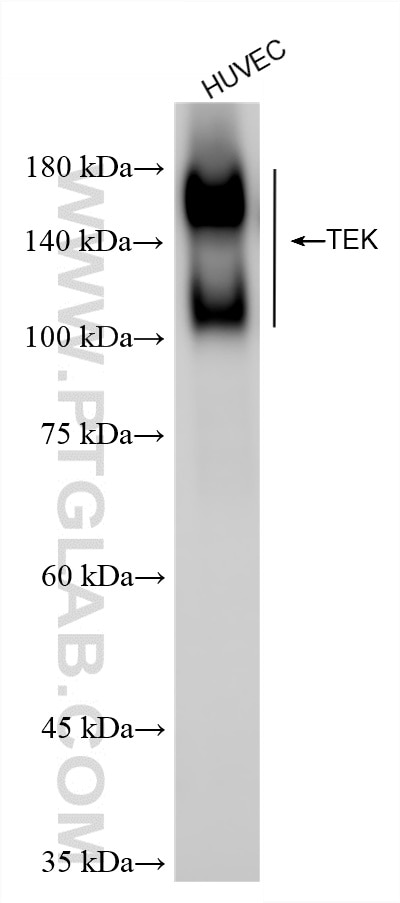 Western Blot (WB) analysis of HUVEC cells using Tie-2/CD202b Recombinant antibody (86010-2-RR)