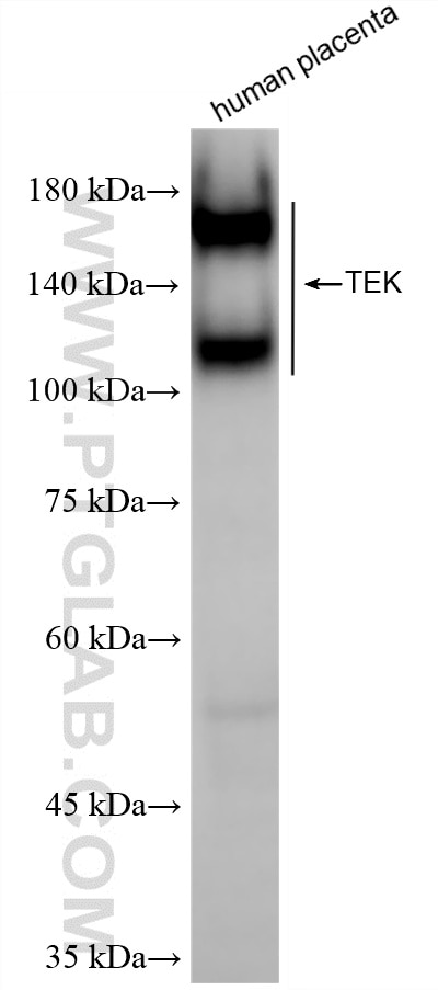 Western Blot (WB) analysis of human placenta tissue using Tie-2/CD202b Recombinant antibody (86010-2-RR)