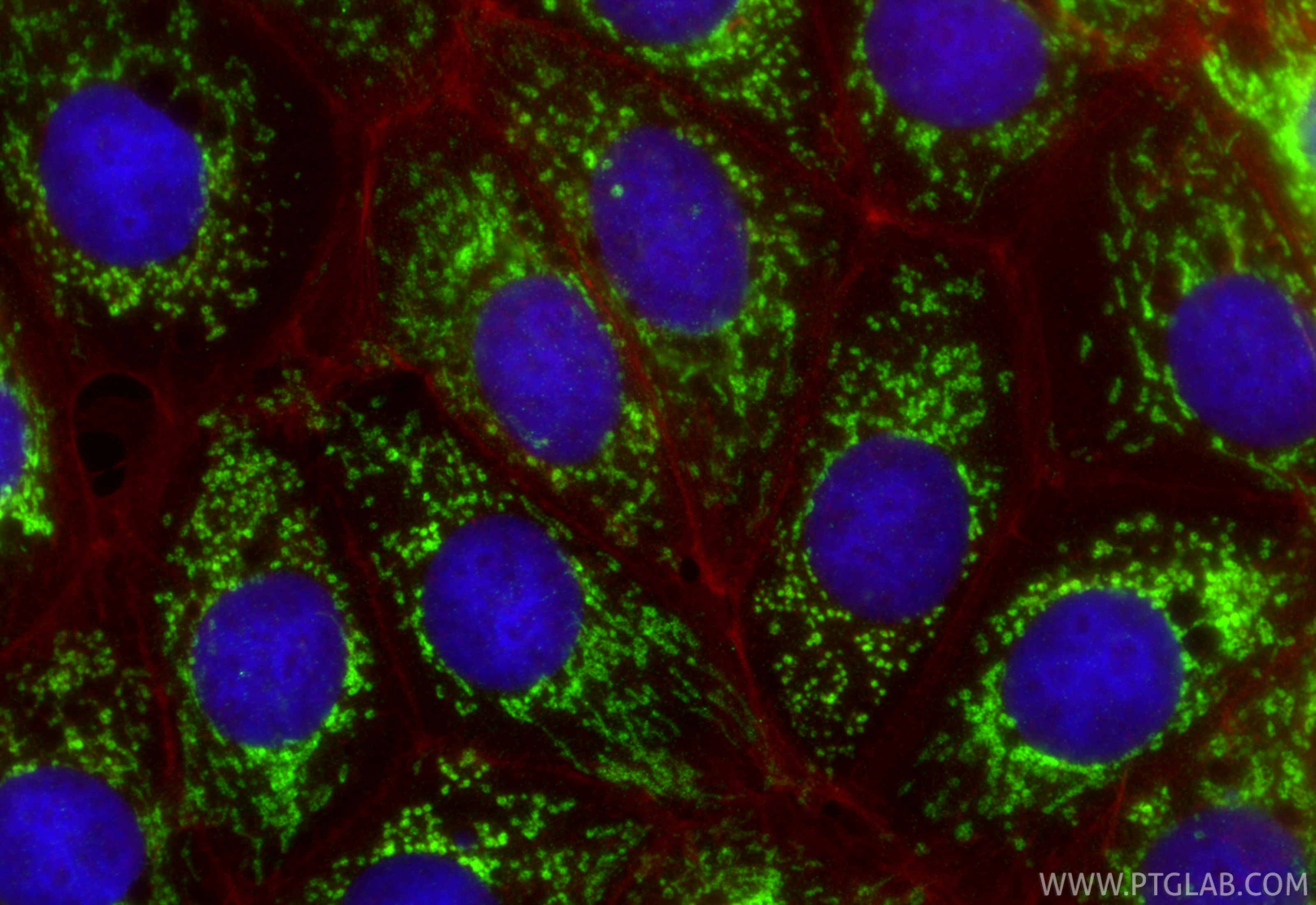 Immunofluorescence (IF) / fluorescent staining of MCF-7 cells using TIM23 Recombinant monoclonal antibody (82540-1-RR)