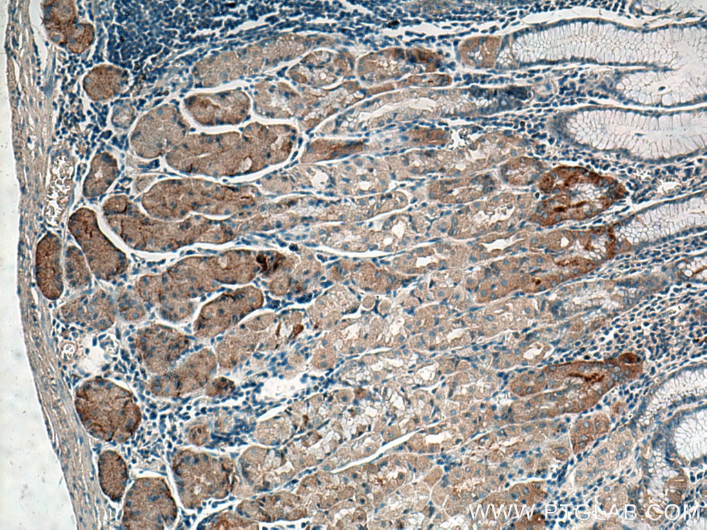 Immunohistochemistry (IHC) staining of human stomach tissue using Timp-3 Polyclonal antibody (10858-1-AP)