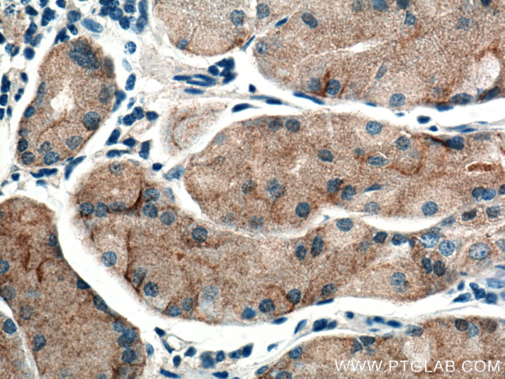 Immunohistochemistry (IHC) staining of human stomach tissue using Timp-3 Polyclonal antibody (10858-1-AP)