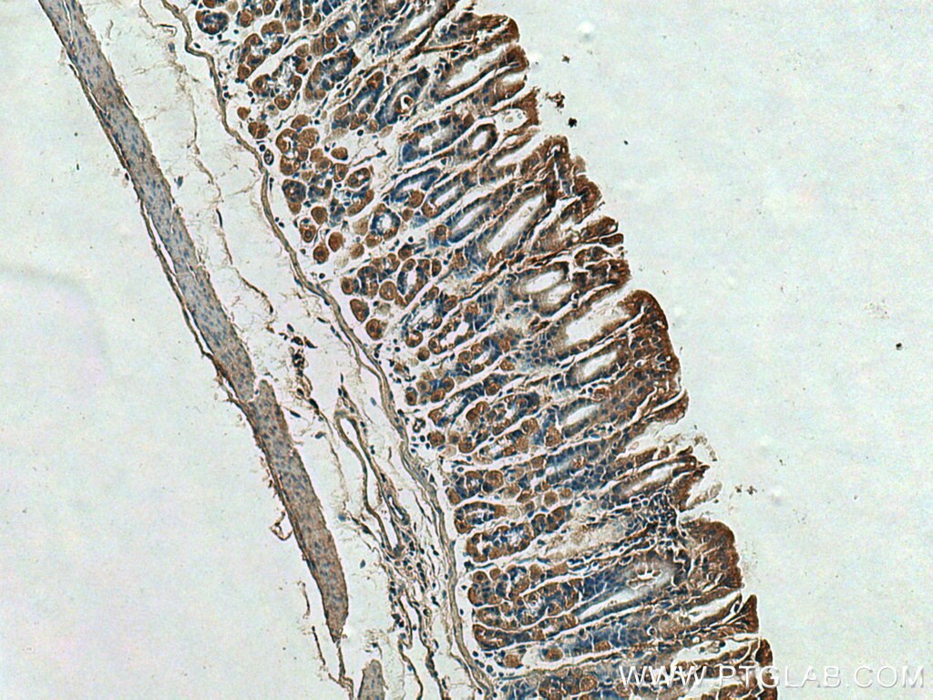 Immunohistochemistry (IHC) staining of mouse stomach tissue using Timp-3 Polyclonal antibody (10858-1-AP)