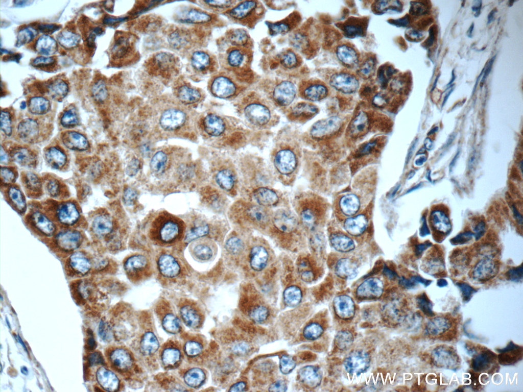 Timp-3 Polyclonal antibody