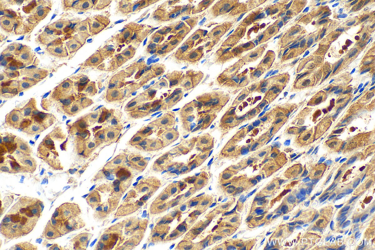 Immunohistochemistry (IHC) staining of mouse stomach tissue using Timp-3 Polyclonal antibody (10858-1-AP)