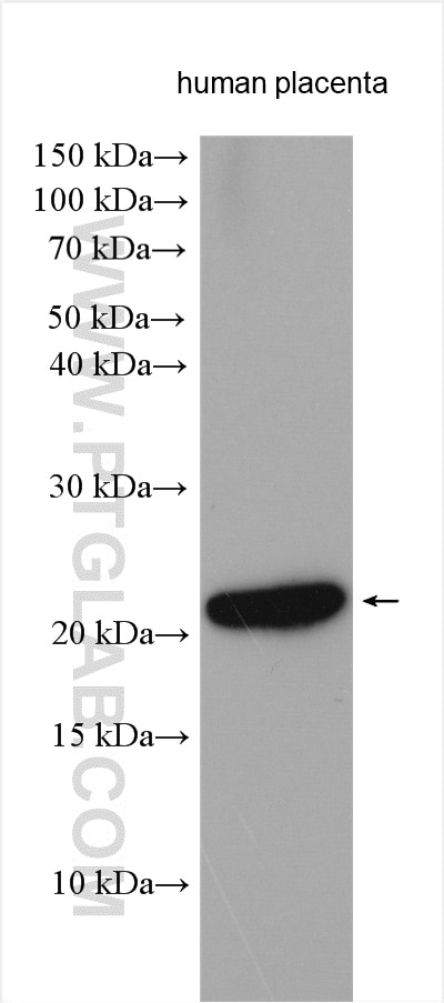 Western Blot (WB) analysis of various lysates using Timp-3 Polyclonal antibody (10858-1-AP)