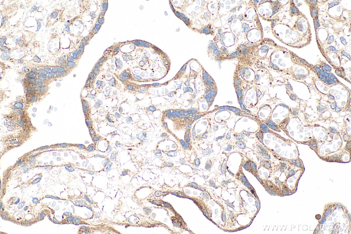 Immunohistochemical analysis of paraffin-embedded human placenta tissue slide using 83627-1-RR (Timp-3 antibody) at dilution of 1:400 (under 40x lens). Heat mediated antigen retrieval with Tris-EDTA buffer (pH 9.0). Immunohistochemistry (IHC) staining of human placenta tissue using Timp-3 Recombinant monoclonal antibody (83627-1-RR)