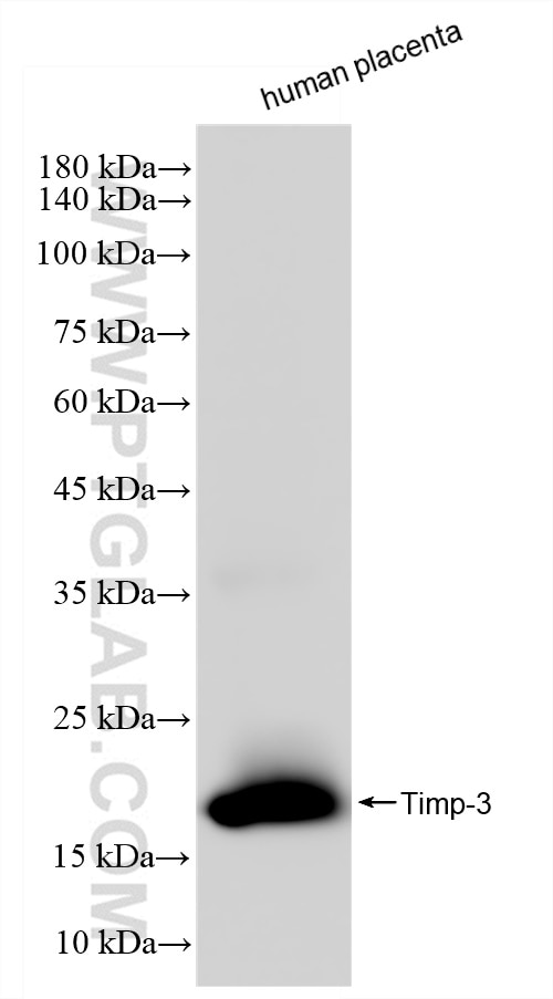 Western Blot (WB) analysis of human placenta tissue using Timp-3 Recombinant antibody (83627-1-RR)