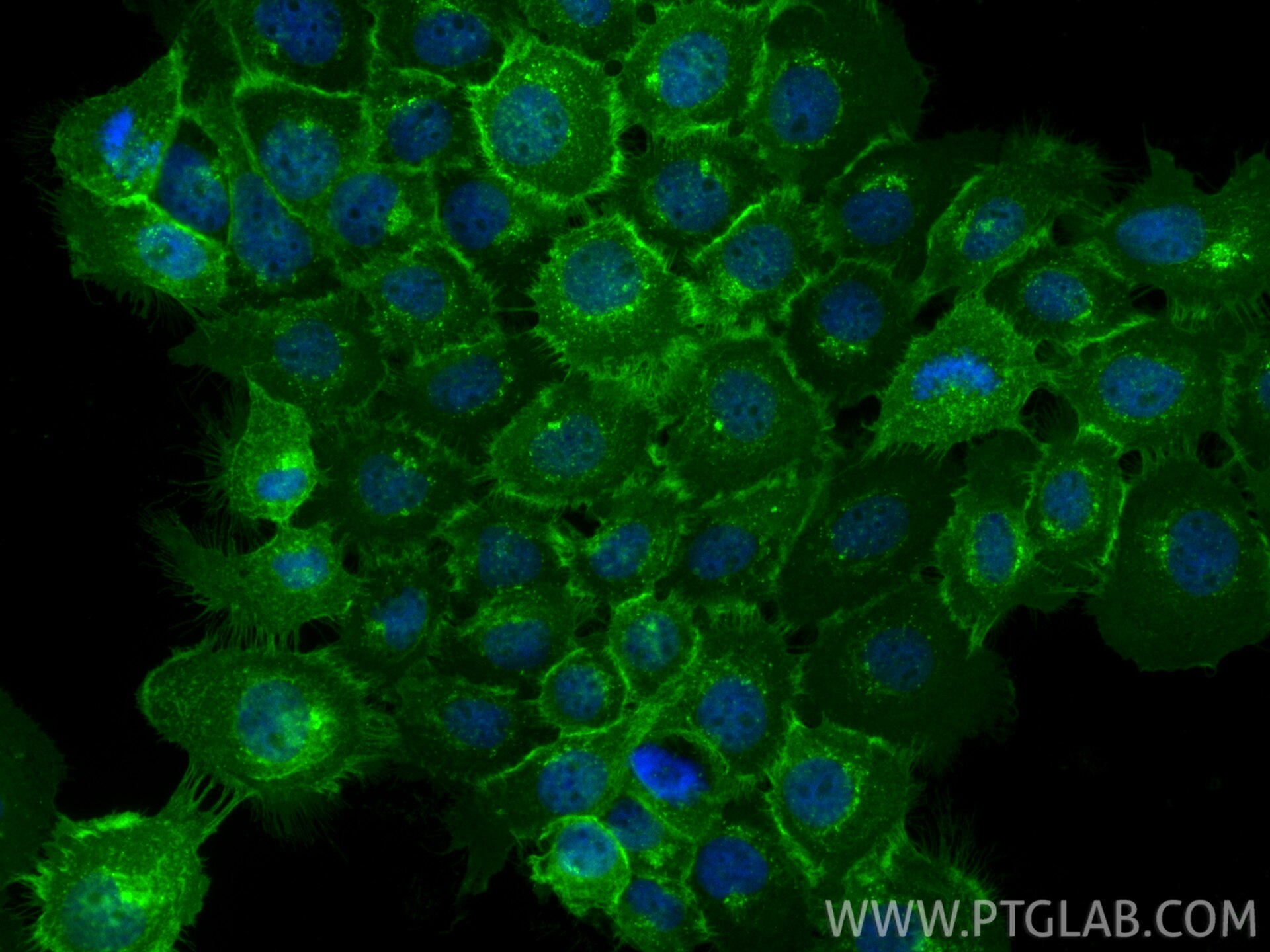 IF Staining of A431 using 31453-1-AP Immunofluorescence (IF) / fluorescent staining of A431 cells using Tissue Factor/CD142 Polyclonal antibody (31453-1-AP)