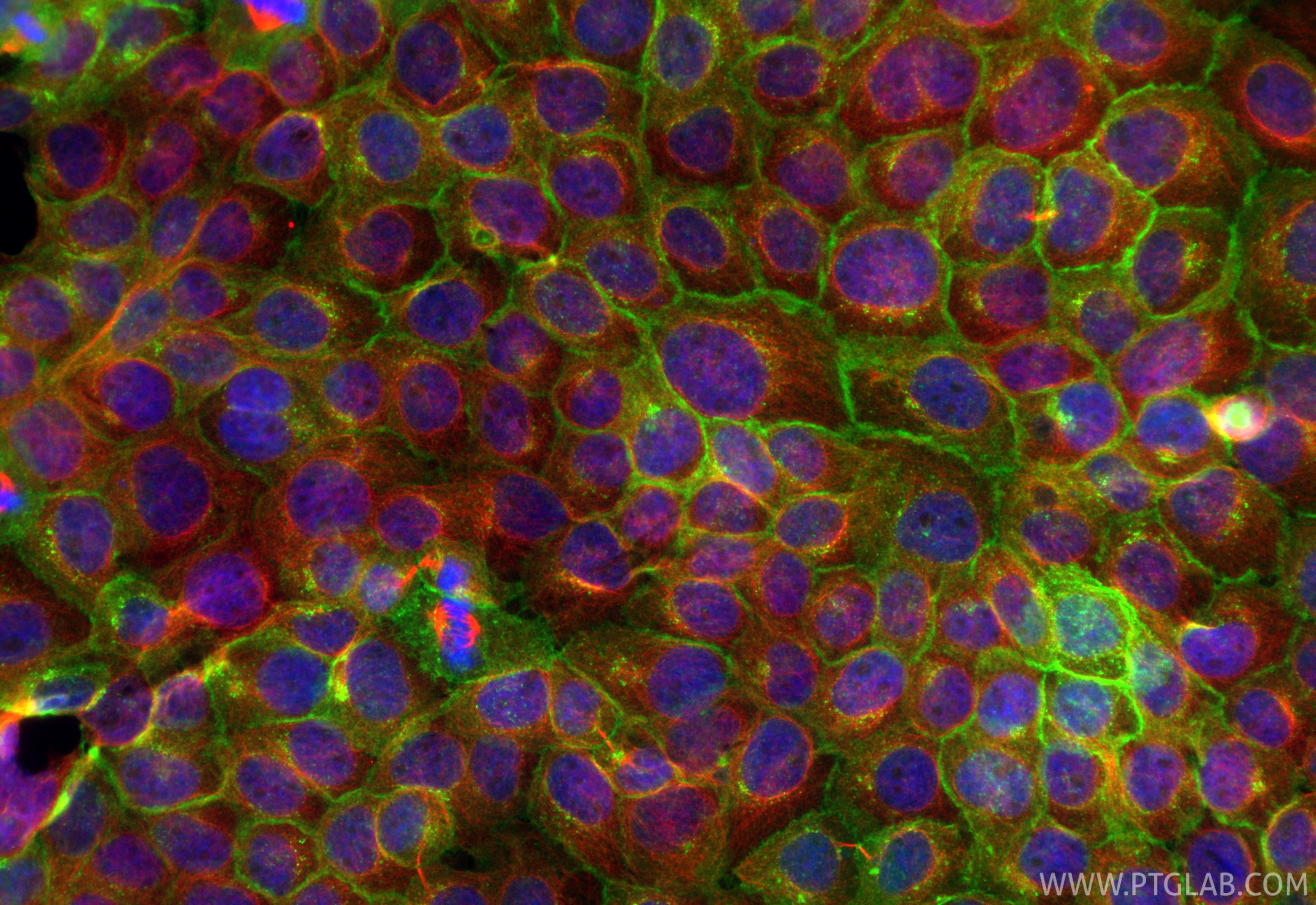 Immunofluorescence (IF) / fluorescent staining of A431 cells using Tissue Factor/CD142 Polyclonal antibody (31453-1-AP)