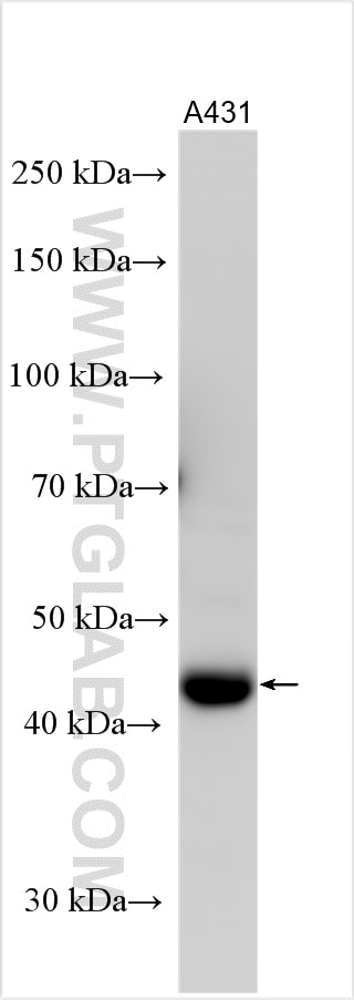 WB analysis using 28005-1-AP