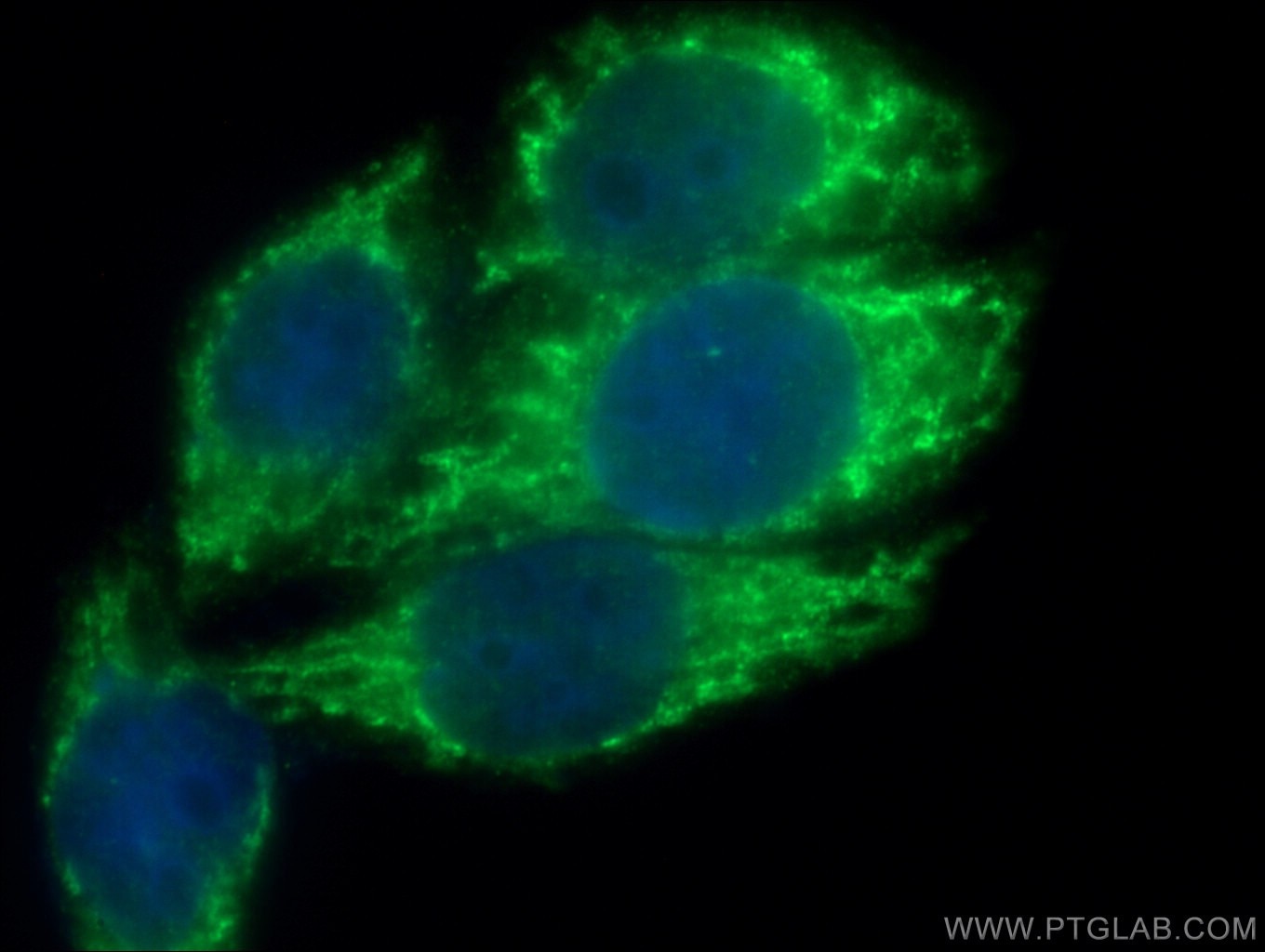 Immunofluorescence (IF) / fluorescent staining of HeLa cells using Titin Polyclonal antibody (27867-1-AP)