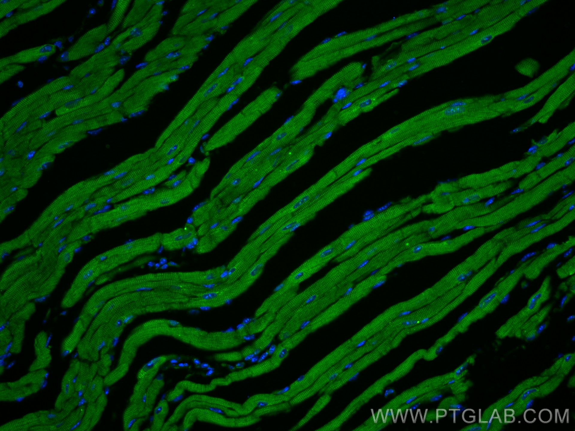 Immunofluorescence (IF) / fluorescent staining of mouse heart tissue using Titin Polyclonal antibody (27867-1-AP)