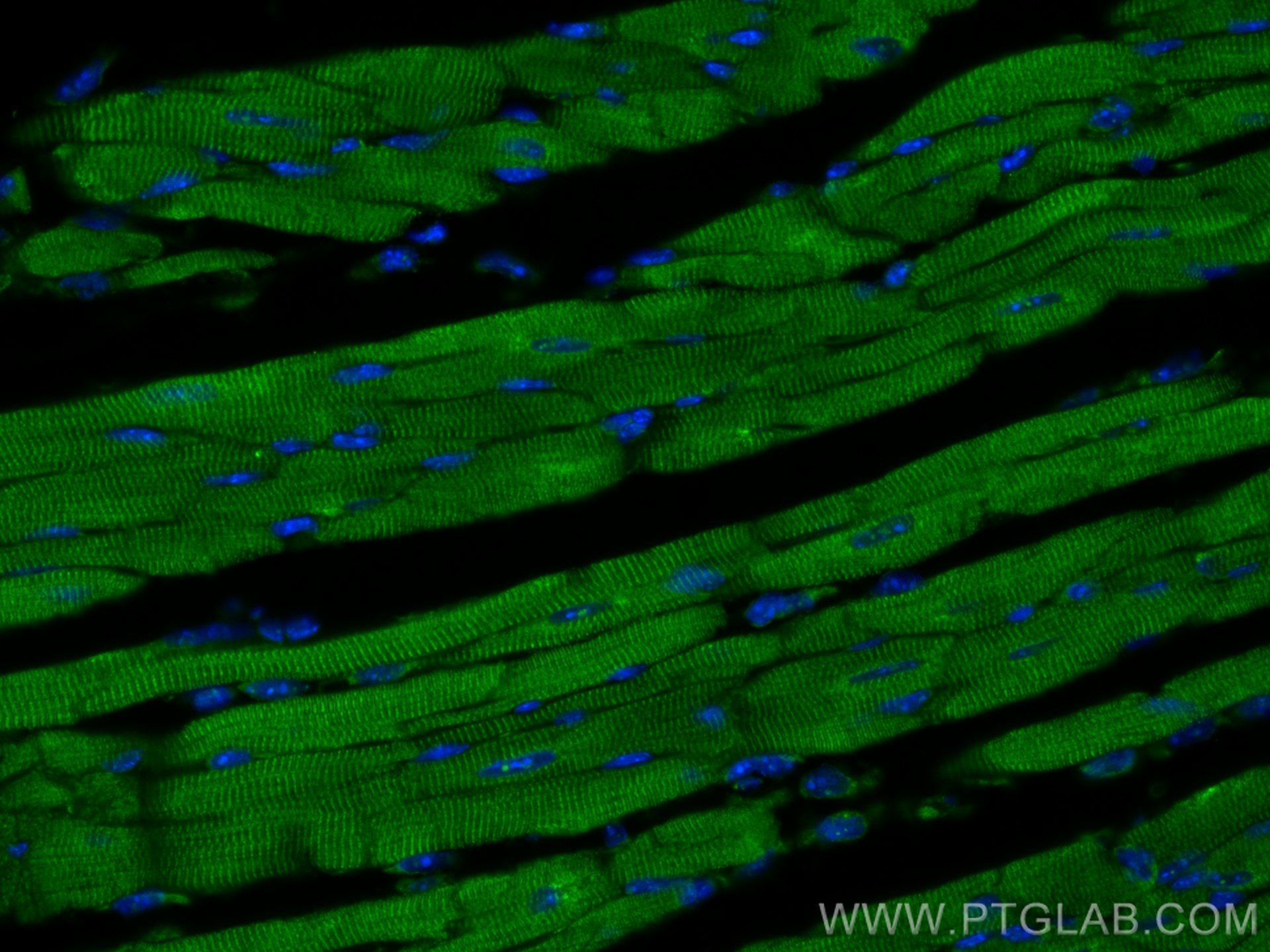 Immunofluorescence (IF) / fluorescent staining of mouse heart tissue using Titin Polyclonal antibody (27867-1-AP)