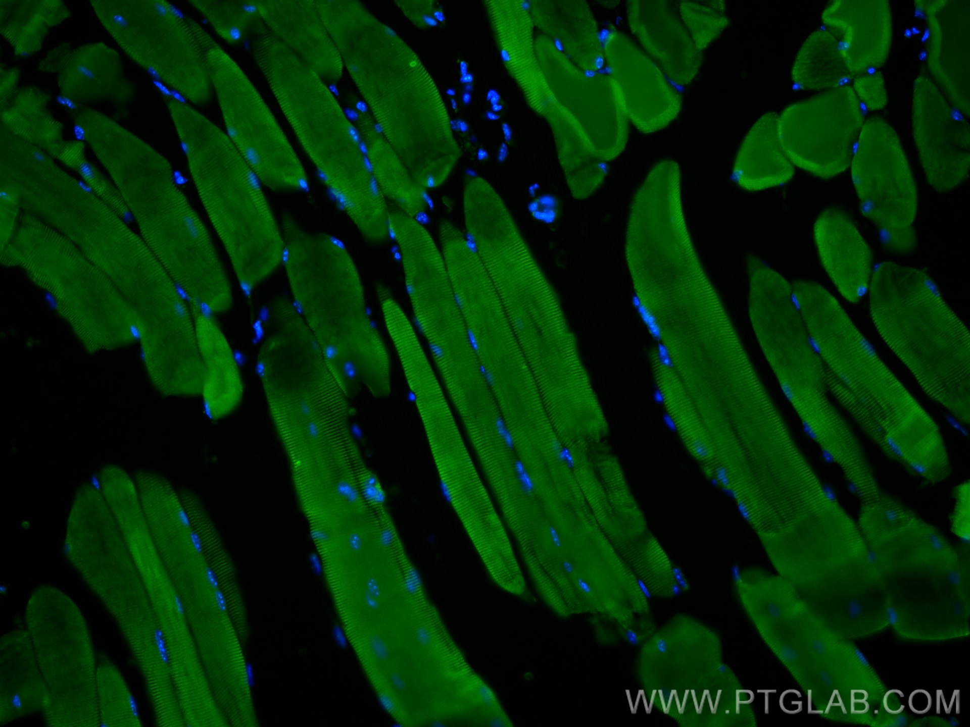 Immunofluorescence (IF) / fluorescent staining of mouse skeletal muscle tissue using Titin Polyclonal antibody (27867-1-AP)