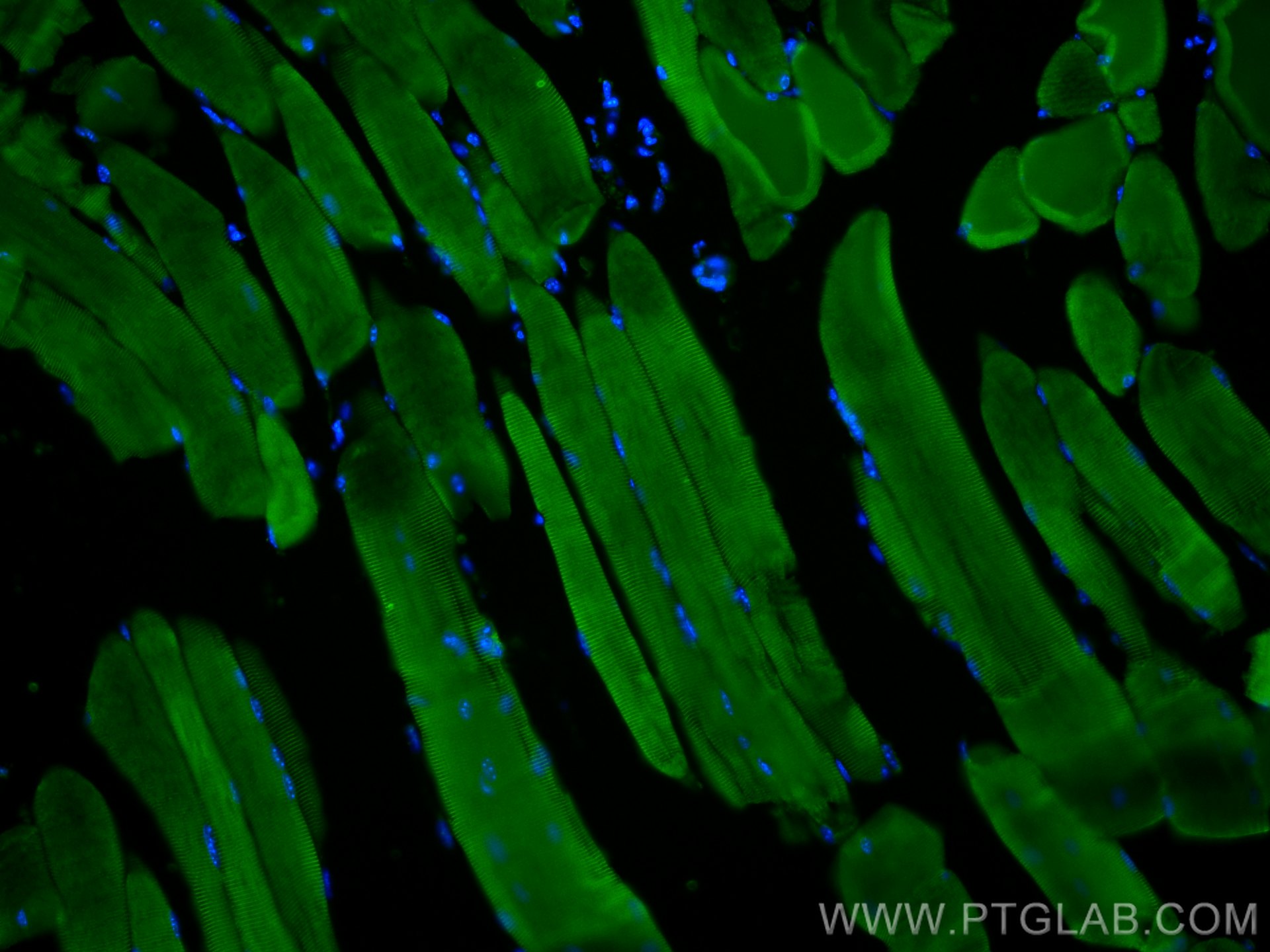 IF Staining of mouse skeletal muscle using 27867-1-AP