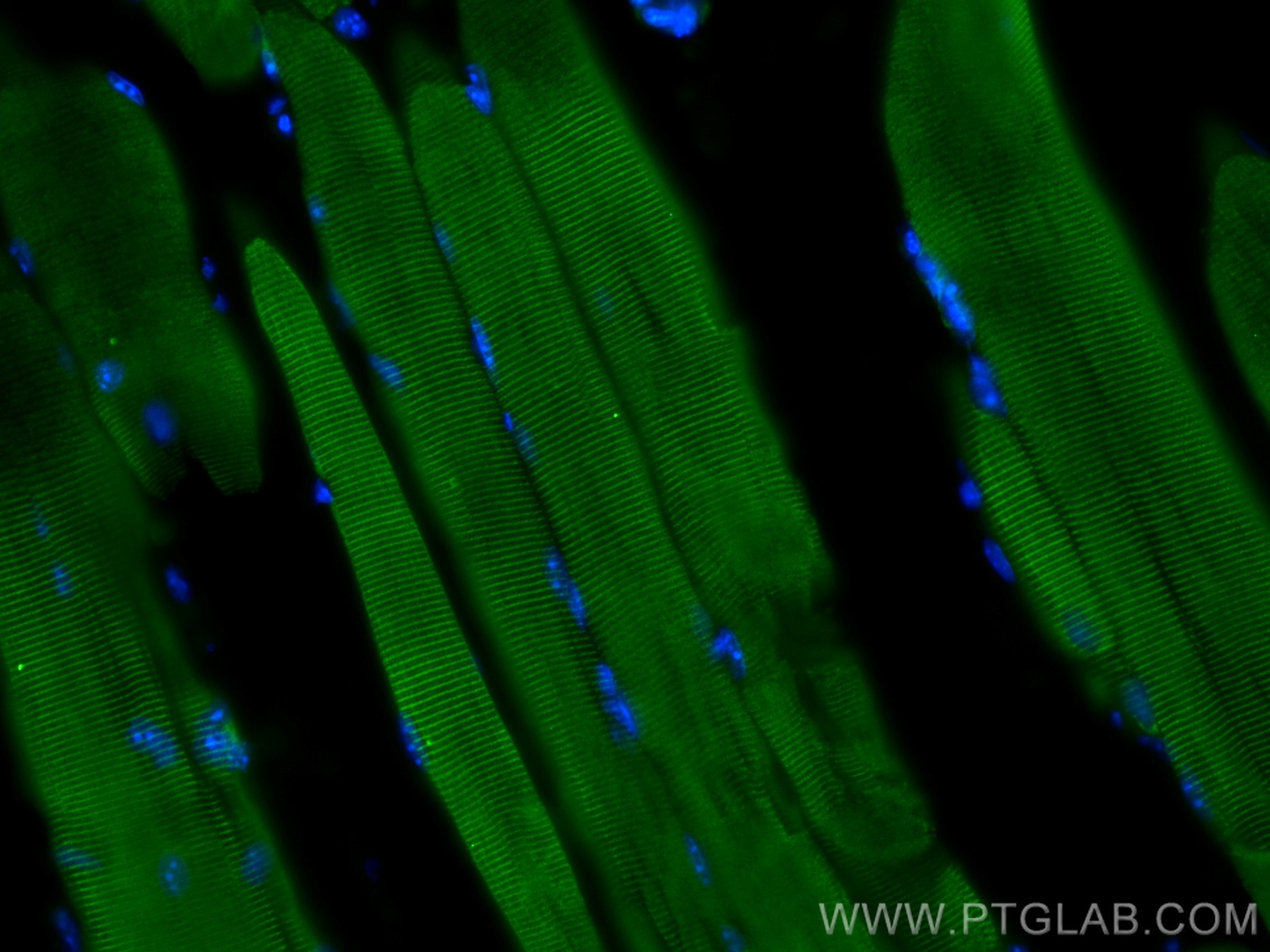 Immunofluorescence (IF) / fluorescent staining of mouse skeletal muscle tissue using Titin Polyclonal antibody (27867-1-AP)