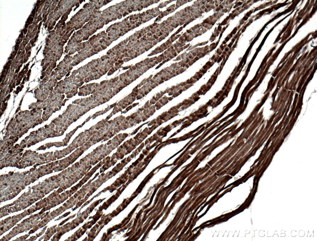Immunohistochemistry (IHC) staining of mouse heart tissue using Titin Polyclonal antibody (27867-1-AP)