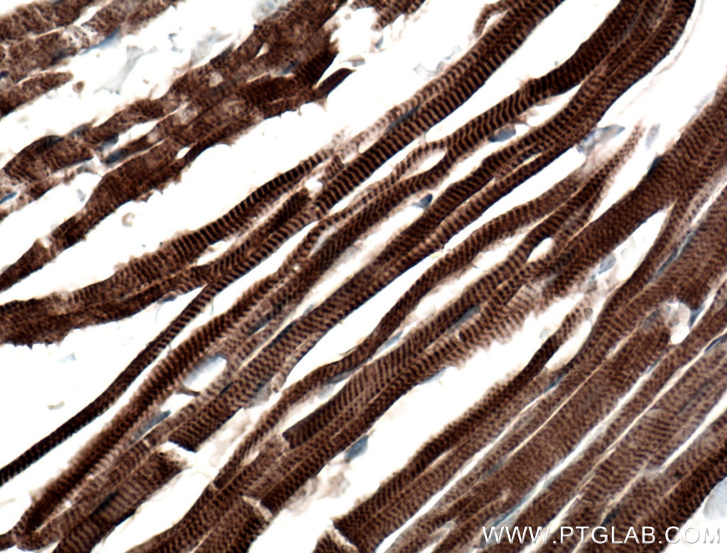 Immunohistochemistry (IHC) staining of mouse heart tissue using Titin Polyclonal antibody (27867-1-AP)