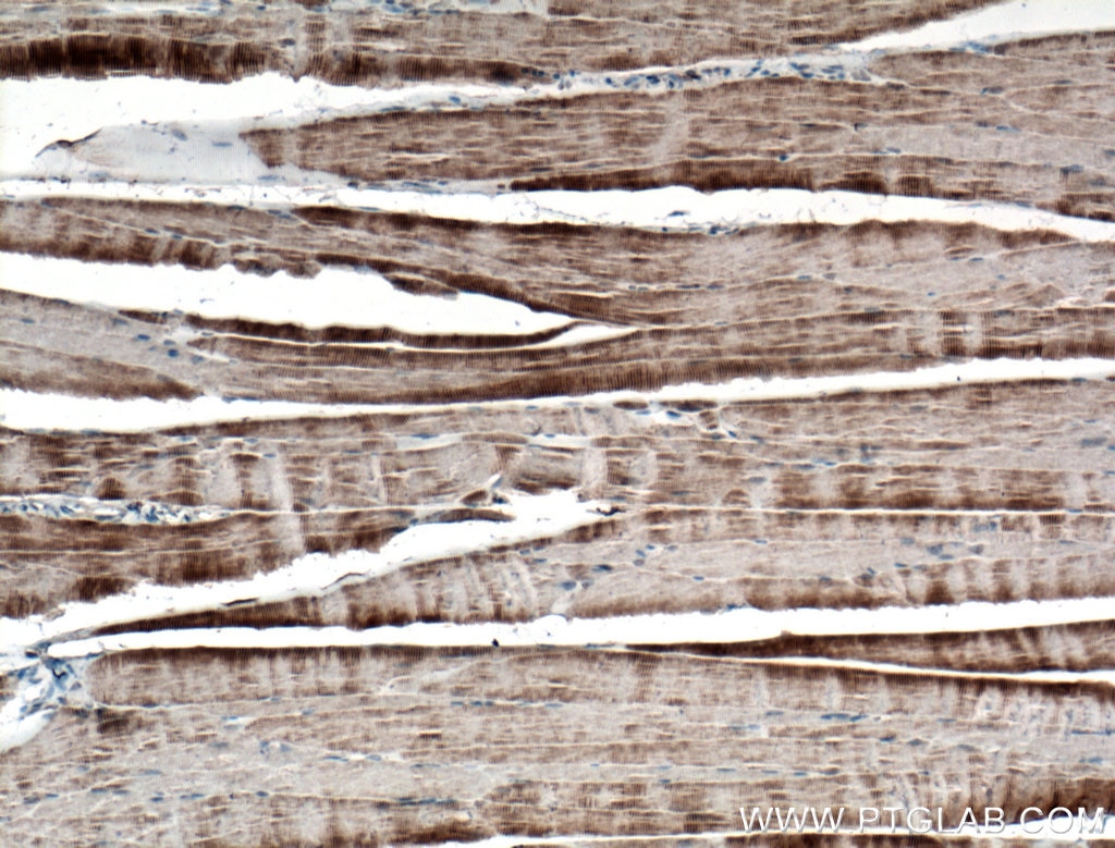 Immunohistochemistry (IHC) staining of mouse skeletal muscle tissue using Titin Polyclonal antibody (27867-1-AP)
