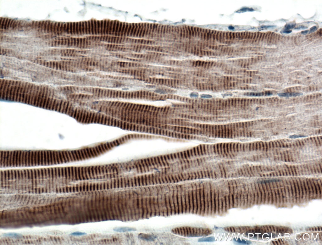 Immunohistochemistry (IHC) staining of mouse skeletal muscle tissue using Titin Polyclonal antibody (27867-1-AP)