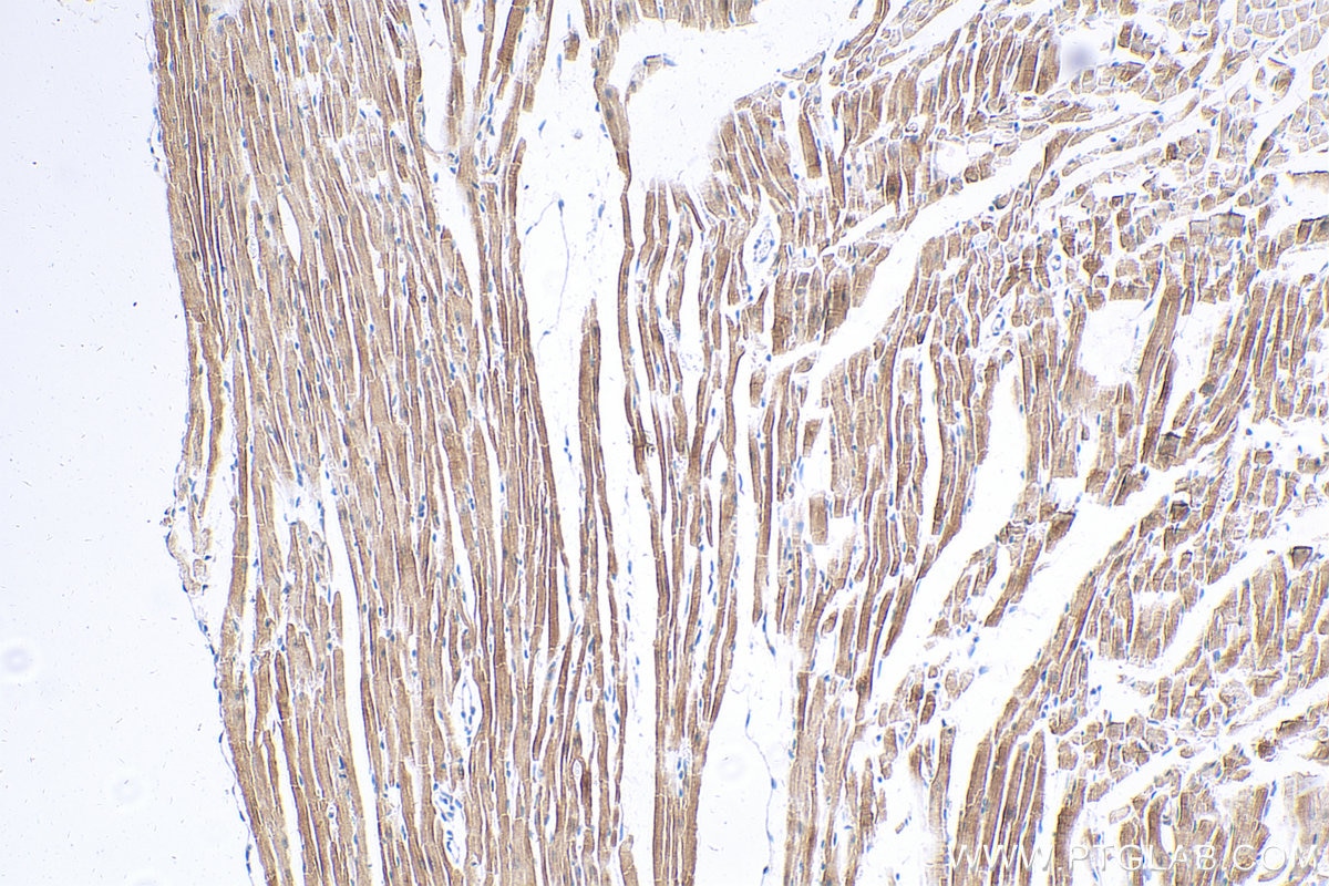 Immunohistochemistry (IHC) staining of mouse heart tissue using Titin Polyclonal antibody (27867-1-AP)