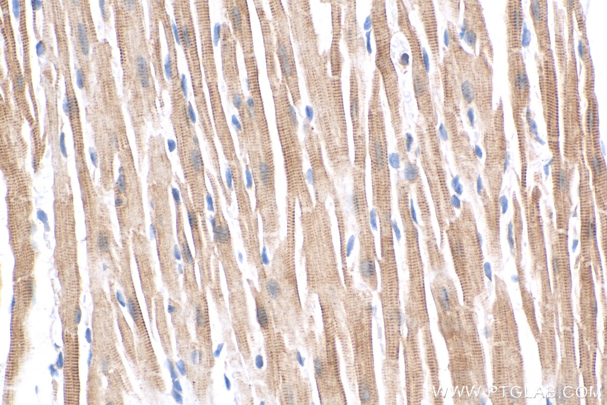 Immunohistochemistry (IHC) staining of mouse heart tissue using Titin Polyclonal antibody (27867-1-AP)