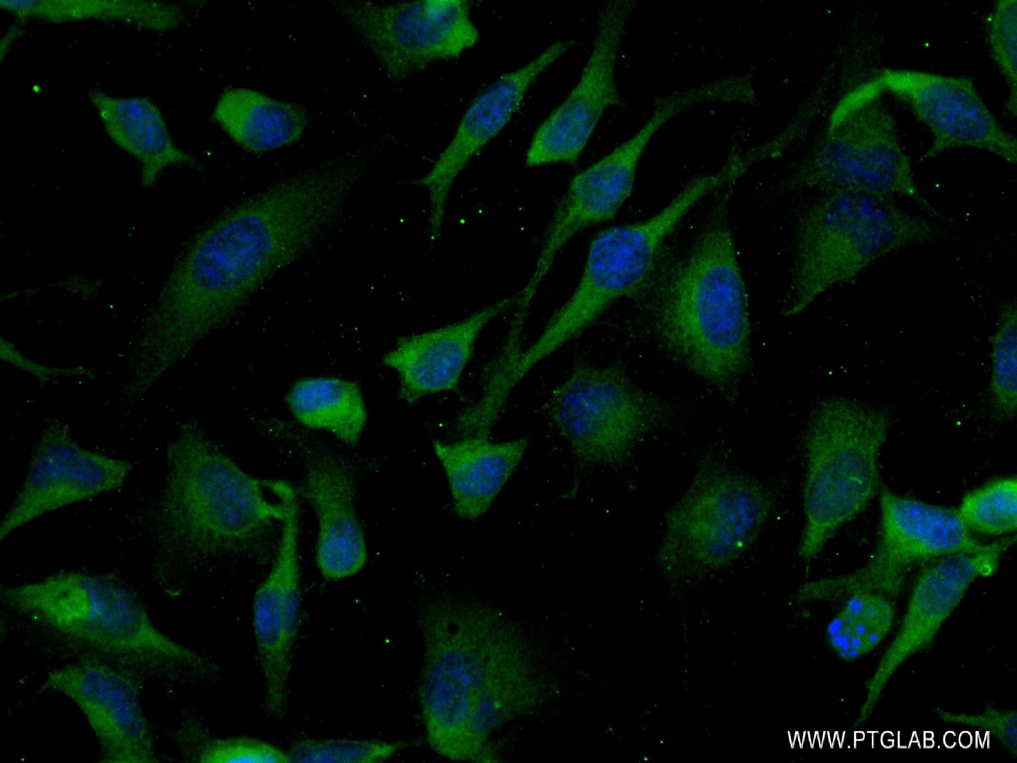 Immunofluorescence (IF) / fluorescent staining of HeLa cells using Tnfrsf11b Recombinant monoclonal antibody (83065-2-RR)
