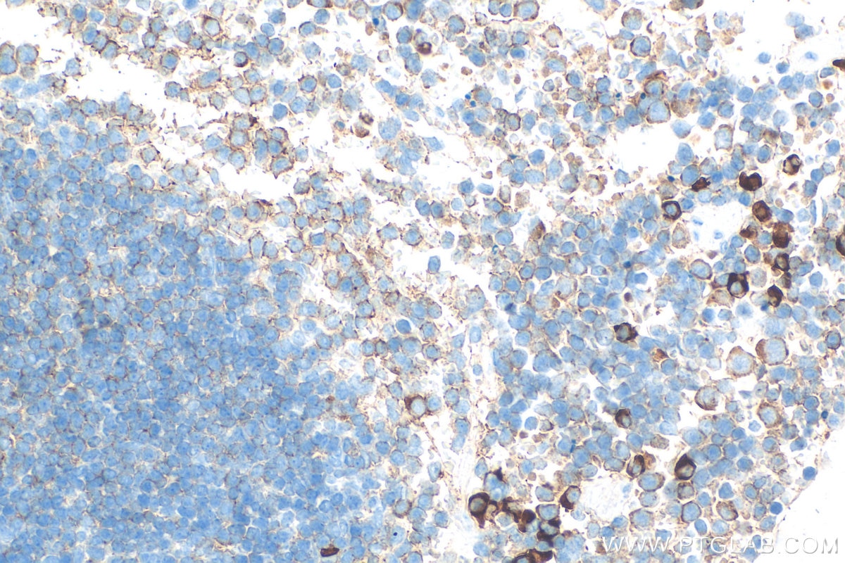 Immunohistochemistry (IHC) staining of mouse spleen tissue using Tnfsf18 Polyclonal antibody (32743-1-AP)