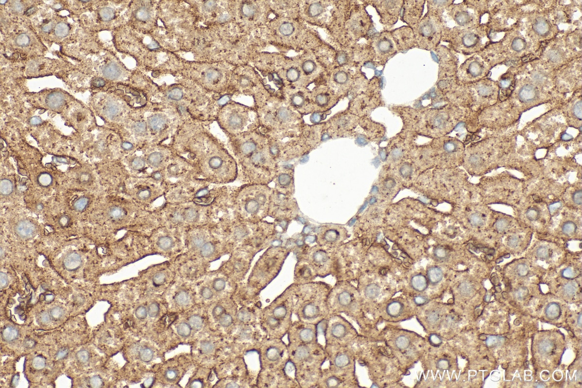 Immunohistochemistry (IHC) staining of mouse liver tissue using Transferrin Receptor 2/TFR2 Polyclonal antibody (32381-1-AP)