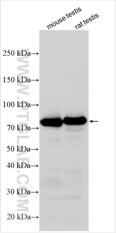 Western Blot (WB) analysis of various lysates using Transferrin/TF Polyclonal antibody (32388-1-AP)