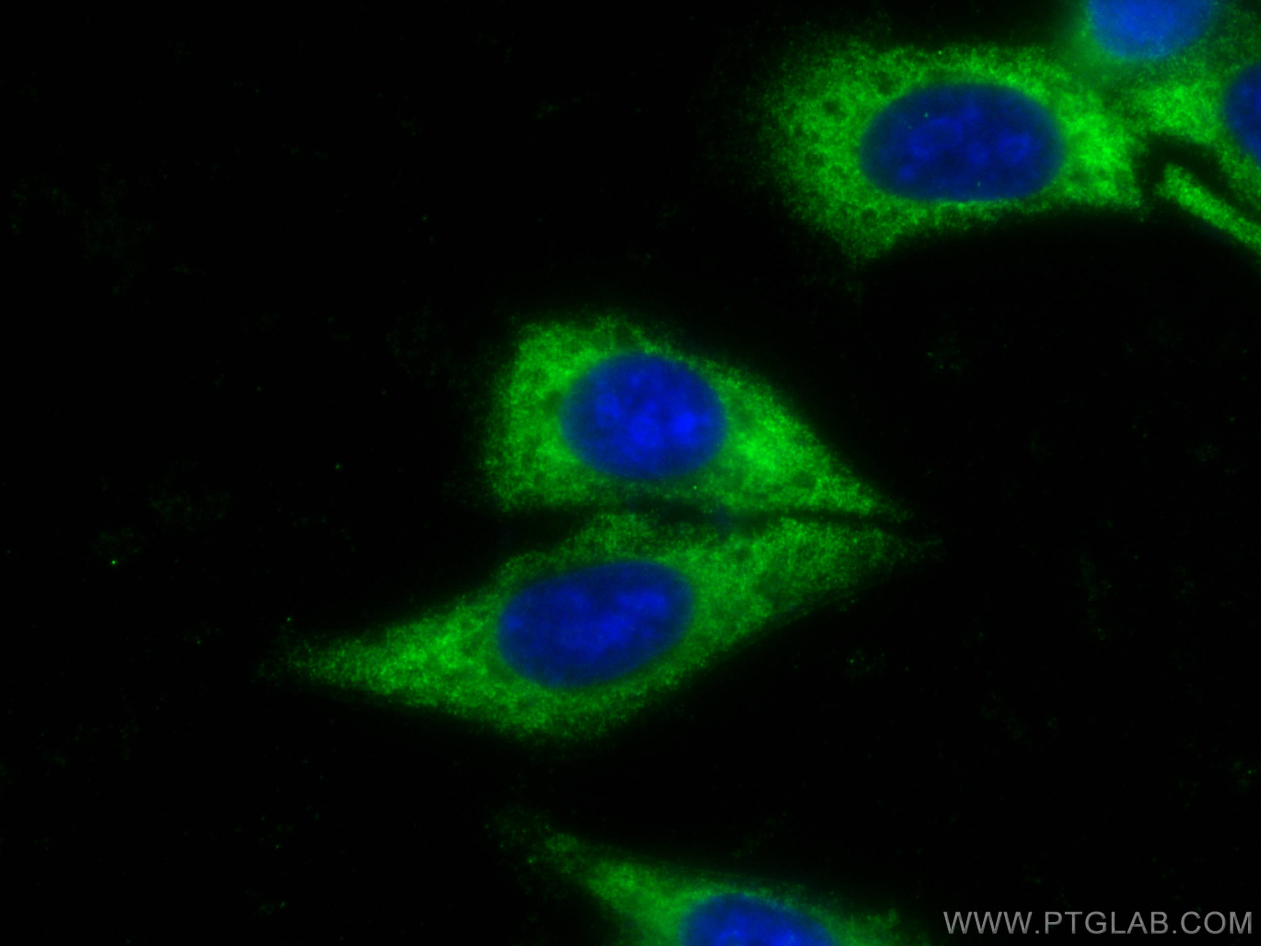 Immunofluorescence (IF) / fluorescent staining of HepG2 cells using CoraLite® Plus 488-conjugated Transgelin 2 Monoclo (CL488-60044)