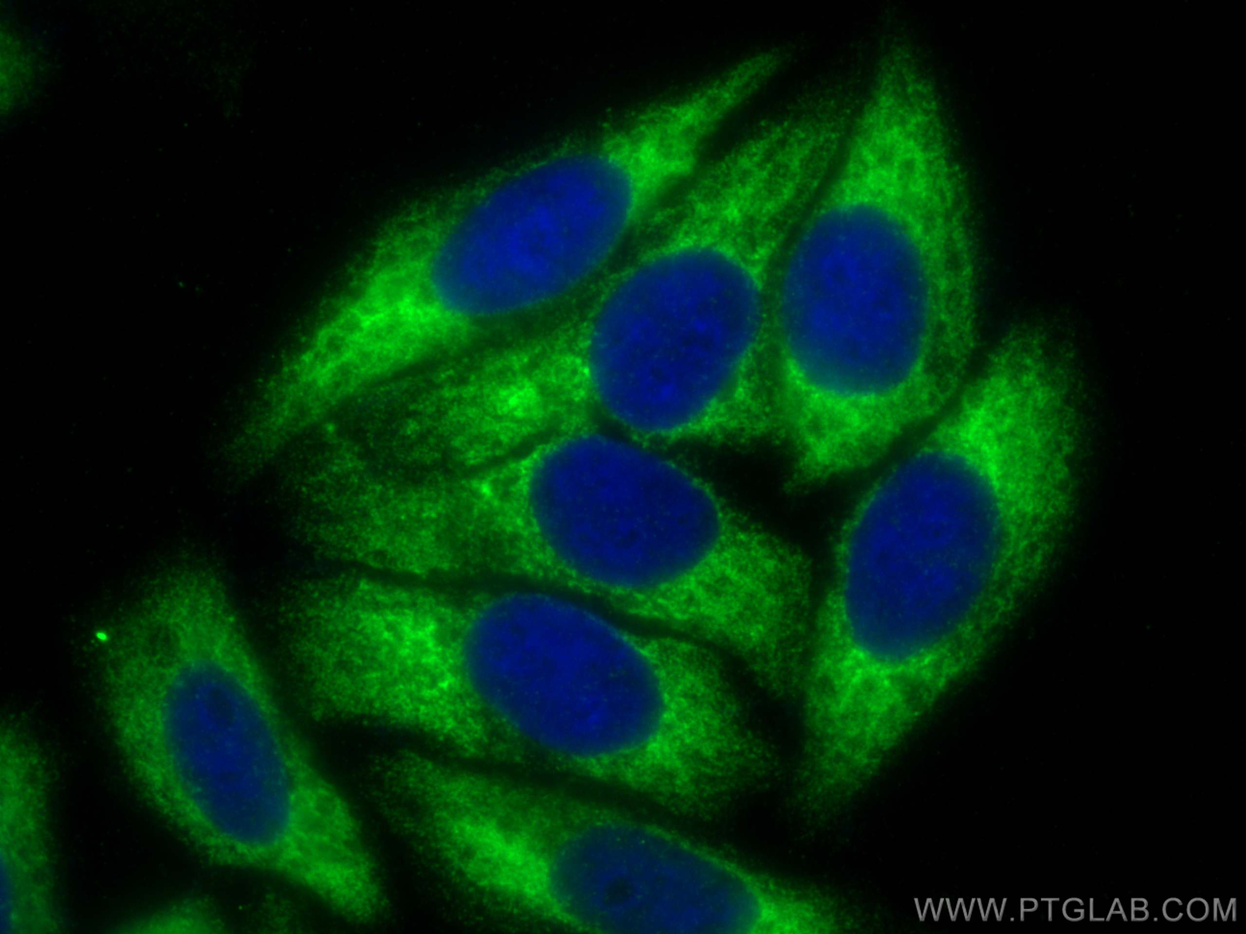 Immunofluorescence (IF) / fluorescent staining of HepG2 cells using Transgelin-2-specific Polyclonal antibody (15508-1-AP)