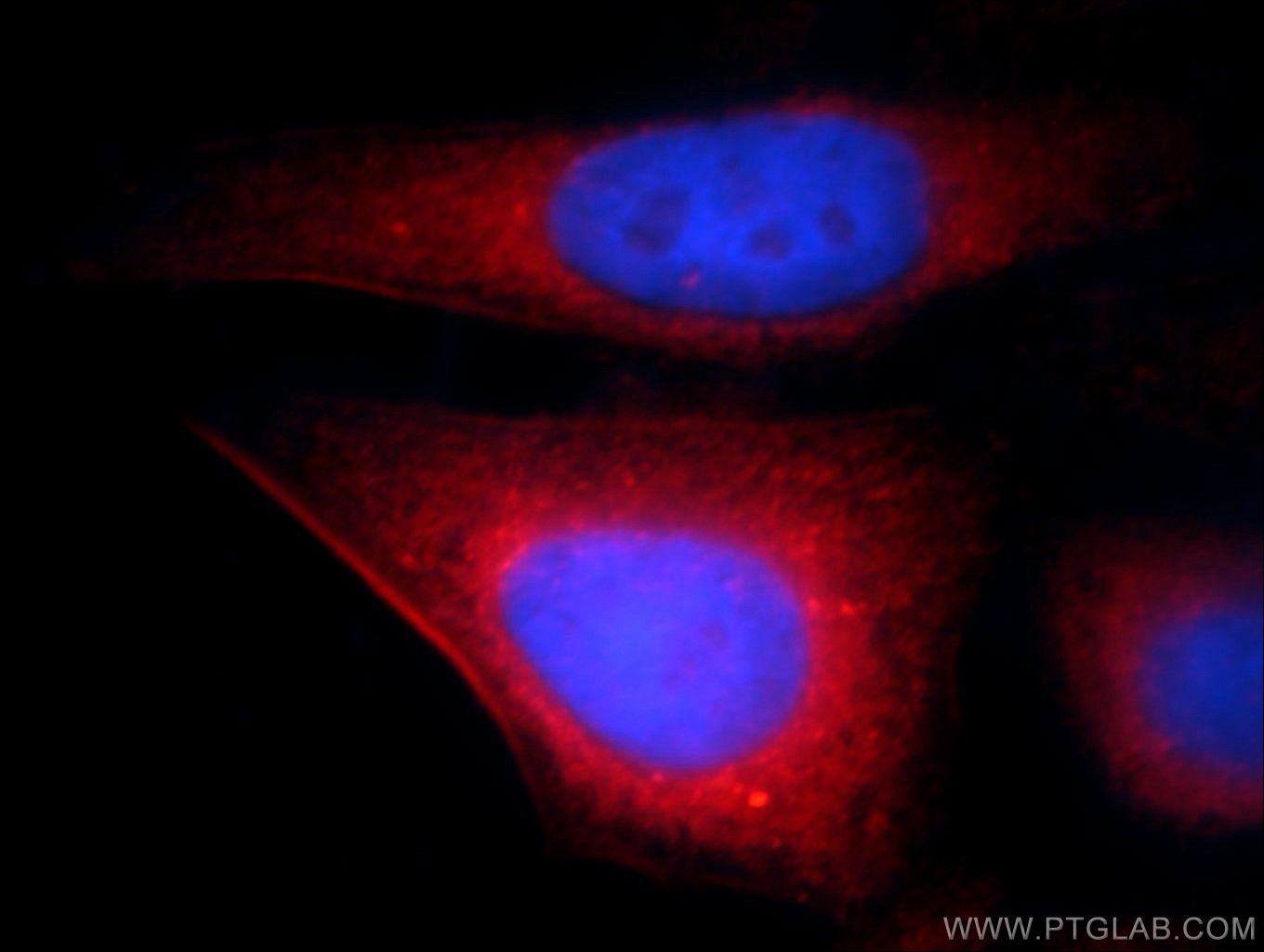 Transgelin-2-specific Polyclonal antibody