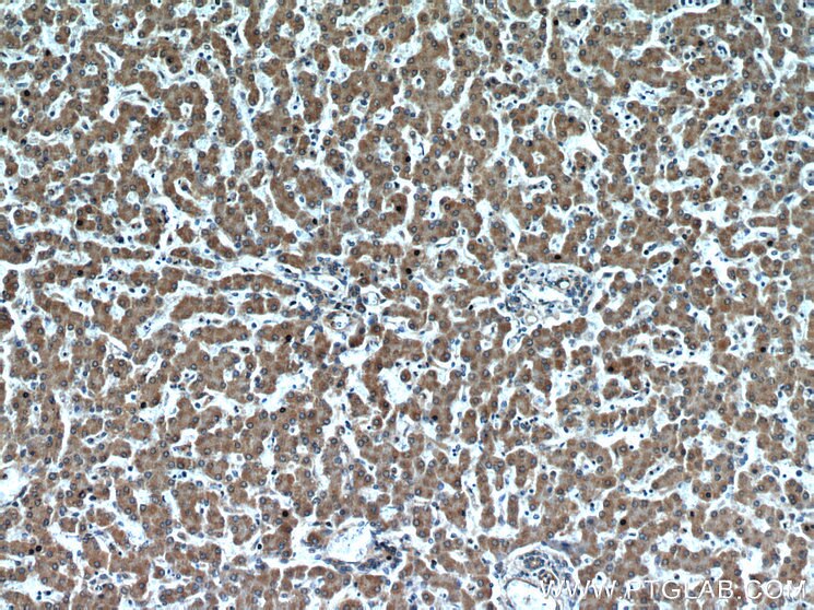 Immunohistochemistry (IHC) staining of human liver tissue using Transgelin-2-specific Polyclonal antibody (15508-1-AP)