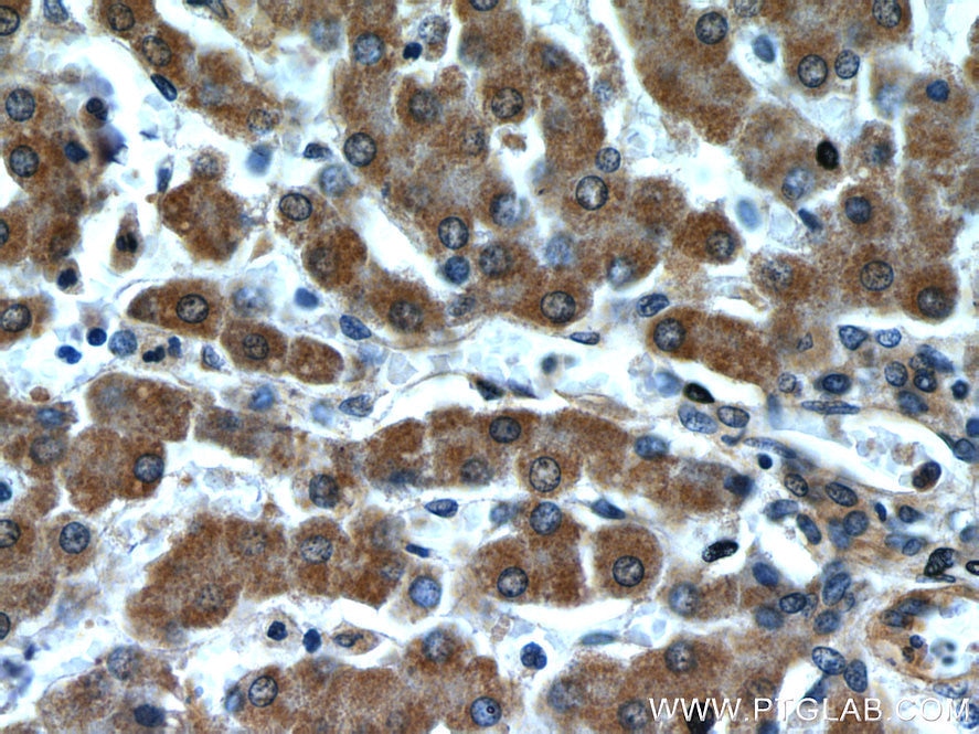 Immunohistochemistry (IHC) staining of human liver tissue using Transgelin-2-specific Polyclonal antibody (15508-1-AP)