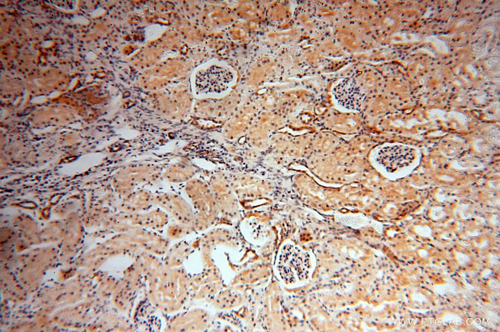 Immunohistochemistry (IHC) staining of human kidney tissue using Transgelin-2-specific Polyclonal antibody (15508-1-AP)