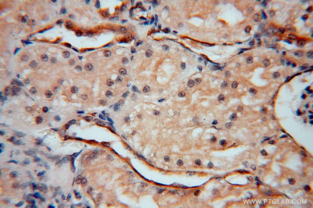 Immunohistochemistry (IHC) staining of human kidney tissue using Transgelin-2-specific Polyclonal antibody (15508-1-AP)